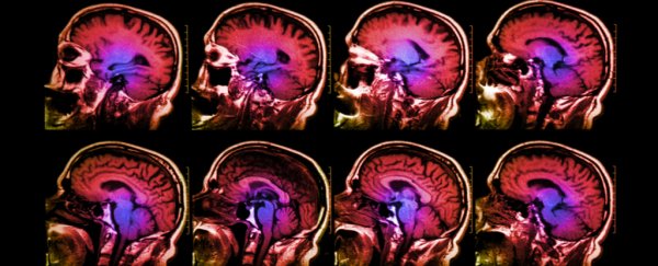 Così sembrerebbe apparire, secondo le ultime ricerche neuroscientifiche, la tristezza a livello cerebrale.