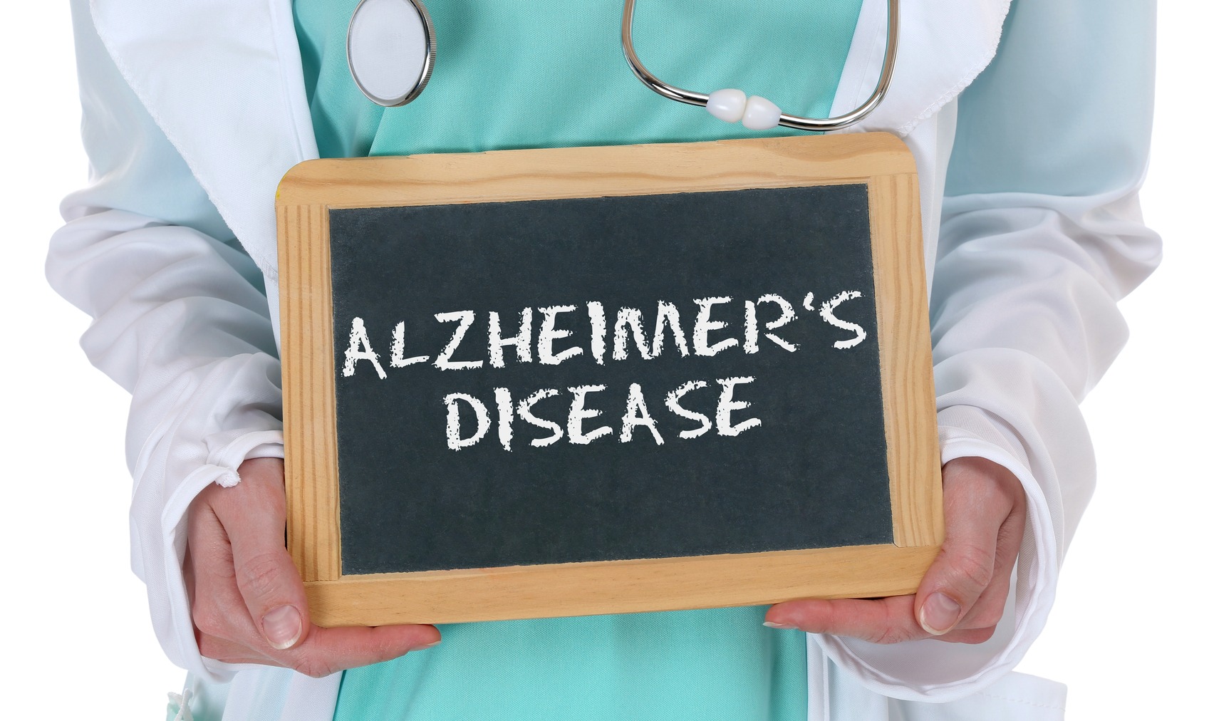 malattia di alzheimer