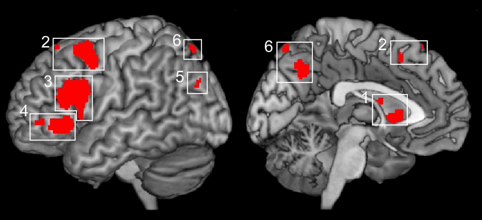 tecniche di neuroimaging